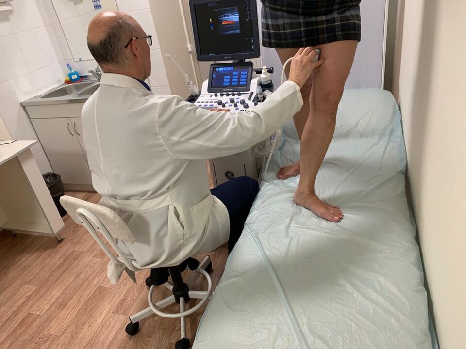 Ultrasound diagnosis of varicose veins